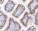 A33 Recombinant Rabbit Monoclonal Antibody (JE49-54)