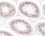 EWSR1 Antibody in Immunohistochemistry (Paraffin) (IHC (P))