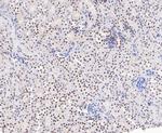 EWSR1 Antibody in Immunohistochemistry (Paraffin) (IHC (P))