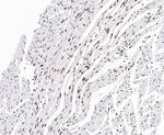 EWSR1 Antibody in Immunohistochemistry (Paraffin) (IHC (P))