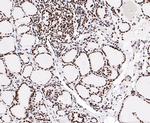 EWSR1 Antibody in Immunohistochemistry (Paraffin) (IHC (P))