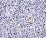 EWSR1 Antibody in Immunohistochemistry (Paraffin) (IHC (P))