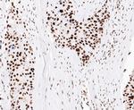 EWSR1 Antibody in Immunohistochemistry (Paraffin) (IHC (P))
