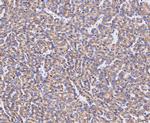ABAT Recombinant Rabbit Monoclonal Antibody (JE50-16)