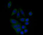 BCL2L12 Recombinant Rabbit Monoclonal Antibody (JE51-66)