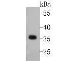 NEK6 Recombinant Rabbit Monoclonal Antibody (JE51-72)