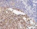 TIMELESS Antibody in Immunohistochemistry (Paraffin) (IHC (P))
