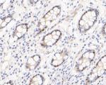 TIMELESS Antibody in Immunohistochemistry (Paraffin) (IHC (P))