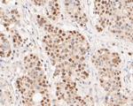 TIMELESS Recombinant Rabbit Monoclonal Antibody (JE51-39)