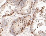 TIMELESS Antibody in Immunohistochemistry (Paraffin) (IHC (P))