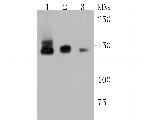 TIMELESS Antibody in Western Blot (WB)