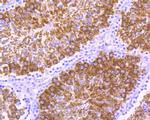 YBX2 Monoclonal Antibody (A2-B9-G6)
