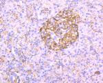 GP130 Antibody in Immunohistochemistry (Paraffin) (IHC (P))