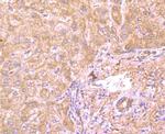 GP130 Antibody in Immunohistochemistry (Paraffin) (IHC (P))