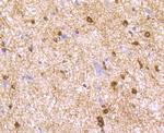 LNP Antibody in Immunohistochemistry (Paraffin) (IHC (P))