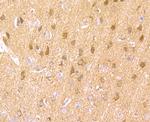 LNP Antibody in Immunohistochemistry (Paraffin) (IHC (P))