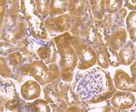 PLEKHH1 Antibody in Immunohistochemistry (Paraffin) (IHC (P))