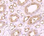 PLEKHH1 Antibody in Immunohistochemistry (Paraffin) (IHC (P))