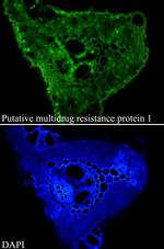 Putative multidrug resistance protein 1 Antibody in Immunohistochemistry (Paraffin) (IHC (P))