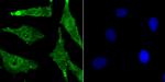 BMI-1 Monoclonal Antibody (A11-C11)