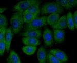 PI3K p85 alpha Monoclonal Antibody (L3-D6)