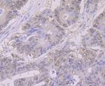 NFIB Antibody in Immunohistochemistry (Paraffin) (IHC (P))