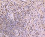 CUGBP1 Antibody in Immunohistochemistry (Paraffin) (IHC (P))