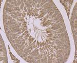 HSP701L Antibody in Immunohistochemistry (Paraffin) (IHC (P))