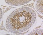 ERp72 Antibody in Immunohistochemistry (Paraffin) (IHC (P))