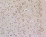 ERp72 Antibody in Immunohistochemistry (Paraffin) (IHC (P))