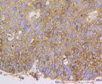 ERp72 Antibody in Immunohistochemistry (Paraffin) (IHC (P))