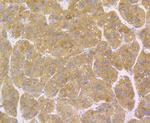 ERp72 Antibody in Immunohistochemistry (Paraffin) (IHC (P))