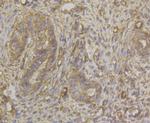 HLA-ABC Antibody in Immunohistochemistry (Paraffin) (IHC (P))