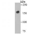 DAPK1 Antibody in Western Blot (WB)