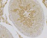 HSP701L Antibody in Immunohistochemistry (Paraffin) (IHC (P))