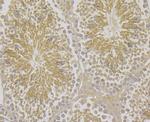 HSP701L Antibody in Immunohistochemistry (Paraffin) (IHC (P))