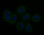 Stathmin 1 Antibody in Immunocytochemistry (ICC/IF)