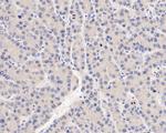 SERPINC1 Monoclonal Antibody (15F2)