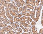 MGST1 Monoclonal Antibody (14H2)