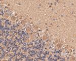 Cathepsin D Monoclonal Antibody (13F2)
