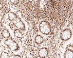 MTA2 Antibody in Immunohistochemistry (Paraffin) (IHC (P))
