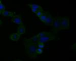 SPATA5L1 Monoclonal Antibody (16A2)