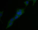 USP21 Monoclonal Antibody (16E1)