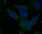 Factor XIII A Antibody in Immunocytochemistry (ICC/IF)