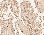 Factor XIII A Antibody in Immunohistochemistry (Paraffin) (IHC (P))