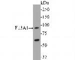 Factor XIII A Antibody in Western Blot (WB)
