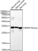 BDNF Monoclonal Antibody (1O9E9)