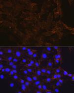 beta Catenin Recombinant Rabbit Monoclonal Antibody (6A3P2)