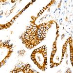 beta Catenin Antibody in Immunohistochemistry (Paraffin) (IHC (P))