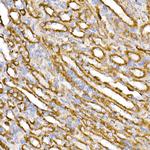 TOM20 Antibody in Immunohistochemistry (Paraffin) (IHC (P))